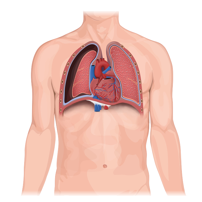 open lung illustration